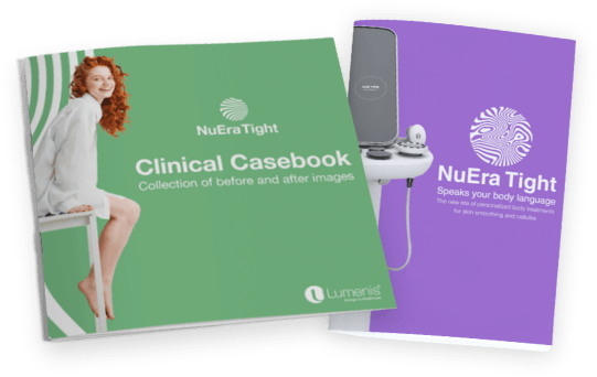 NuEra Tight Machine